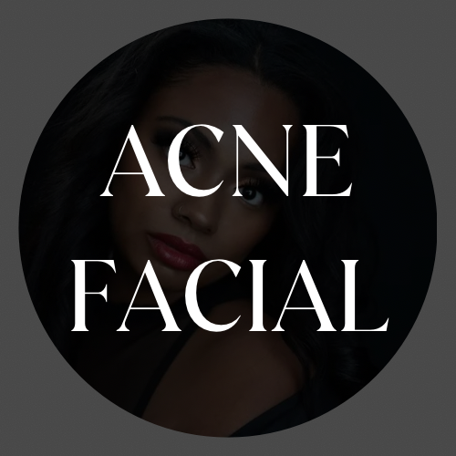 Tiarre - Acne Facial